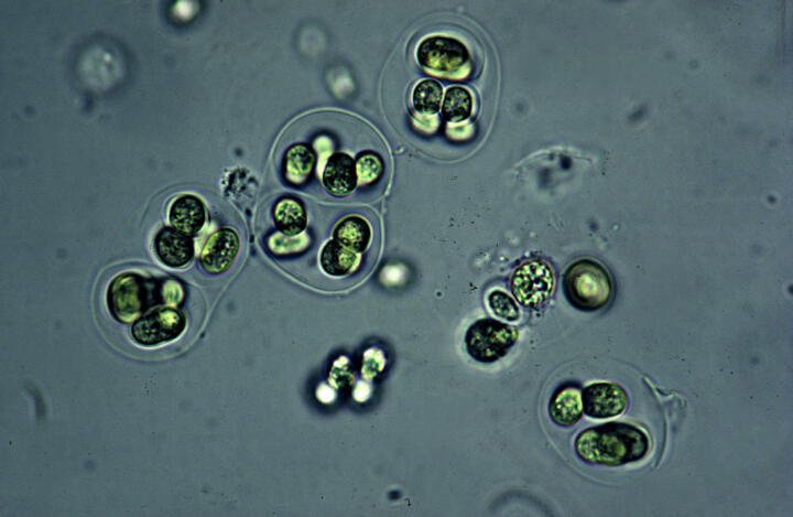 Biointegration – the perfect bioplastics? Researchers at the University of Tübin ...